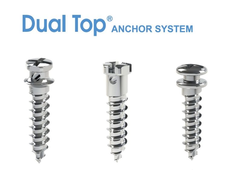 Dual Top Anchor System