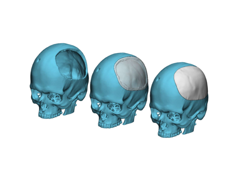 Skulls