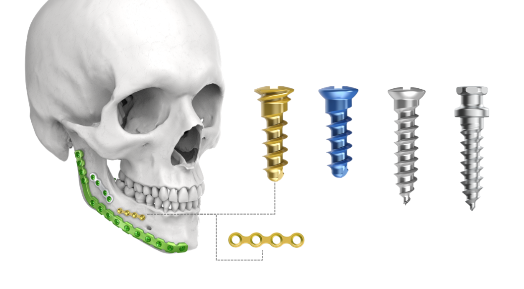 Sterile LeForte System Bone Screw / Bone Plate